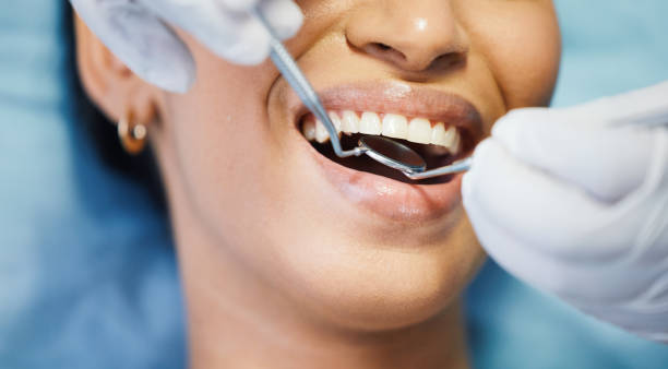 Best Emergency Wisdom Teeth Removal in Arnaudville, LA